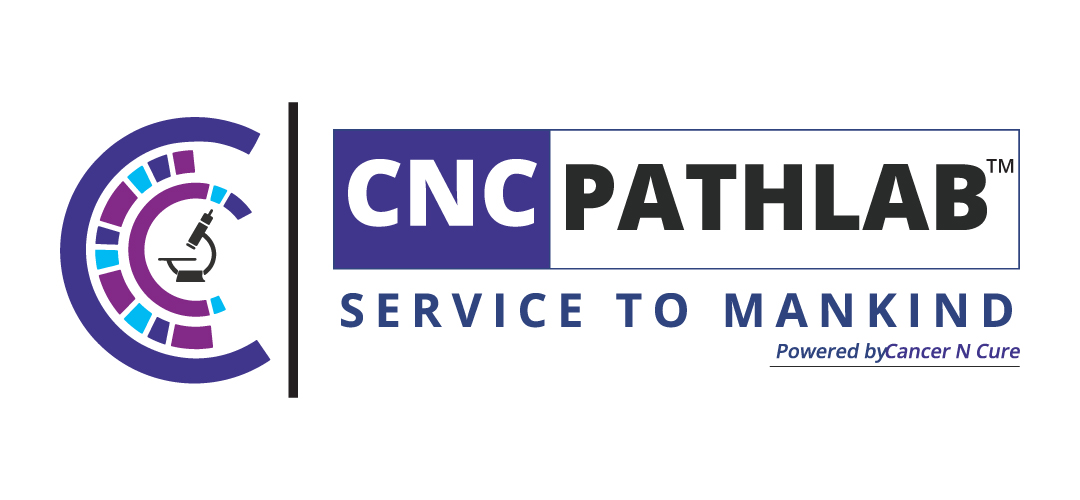 Full Body Checkup Price in Delhi